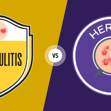 Celebrities With Herpes: Full List of Famous People With HSV, Rumors, and Confirmed Cases